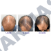 Anti Hair Loss Serum Hair Growth